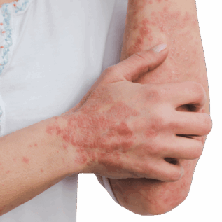 harcèlement moral symptômes physiques